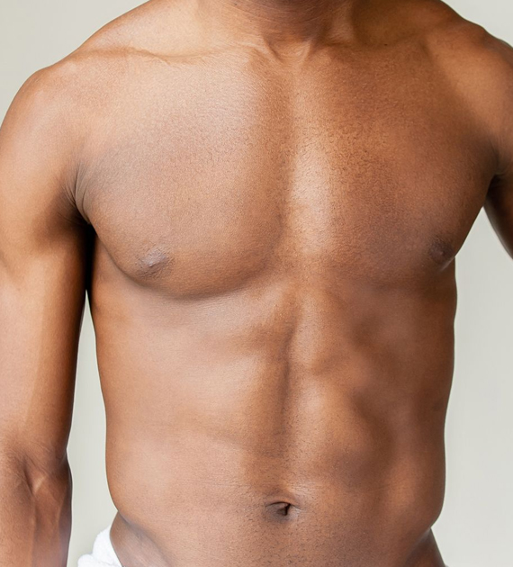 Gynecomastia Consultation Image